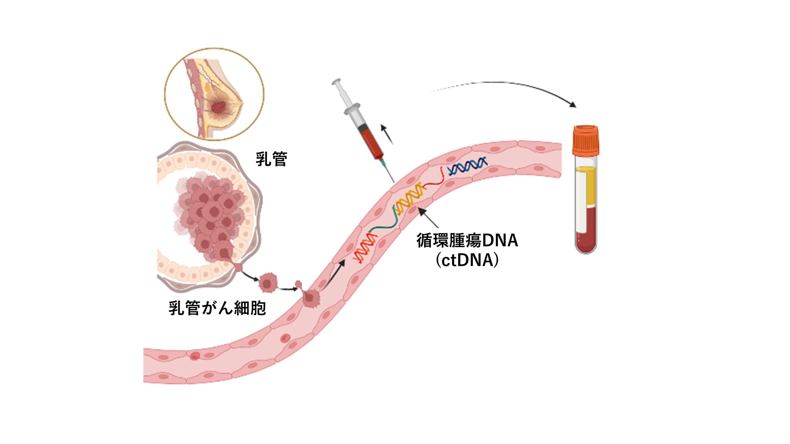 血中の循環腫瘍DNA (ctDNA)の有無を検査イメージ